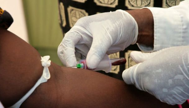 VIH-de-nouveaux-tests-d-efficacite-du-traitement-en-Afrique_width585